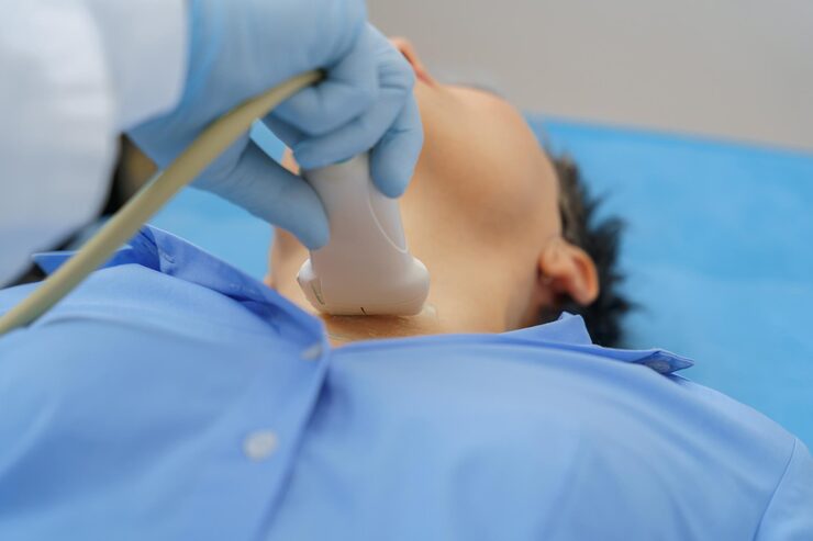 Carotid Doppler